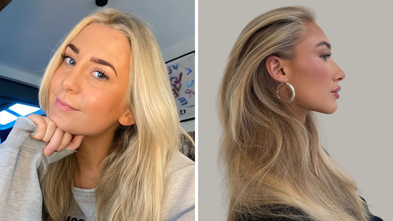 scandinavian hairline trend 2025